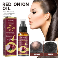 Load image into Gallery viewer, Onion Hair Essential Oil Spray