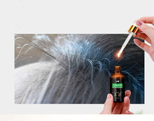 Load image into Gallery viewer, Talent Hair Growth Repair Hair Follicle Essential Oil