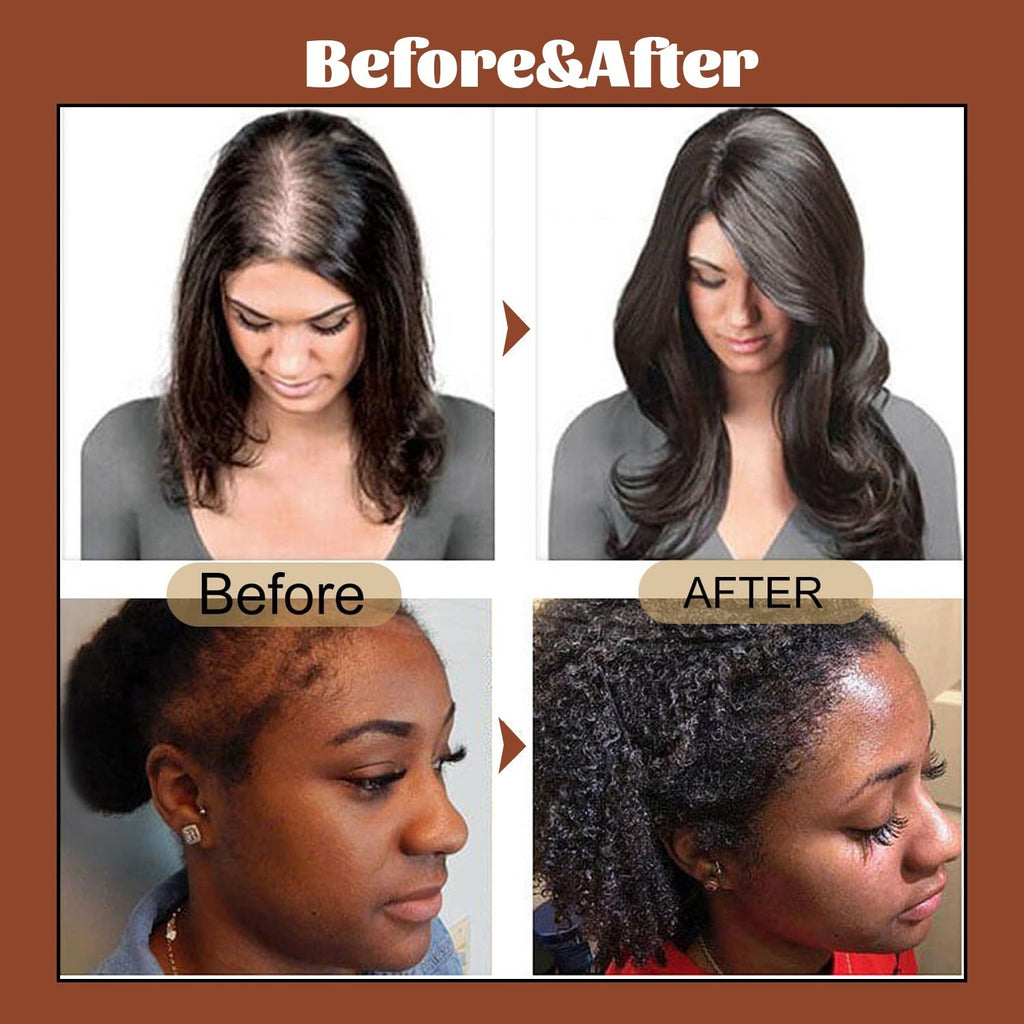 Promote Hair Growth And Care With Hair Oil