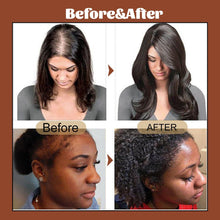 Load image into Gallery viewer, Promote Hair Growth And Care With Hair Oil